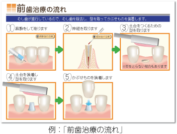 治療の流れ説明シート